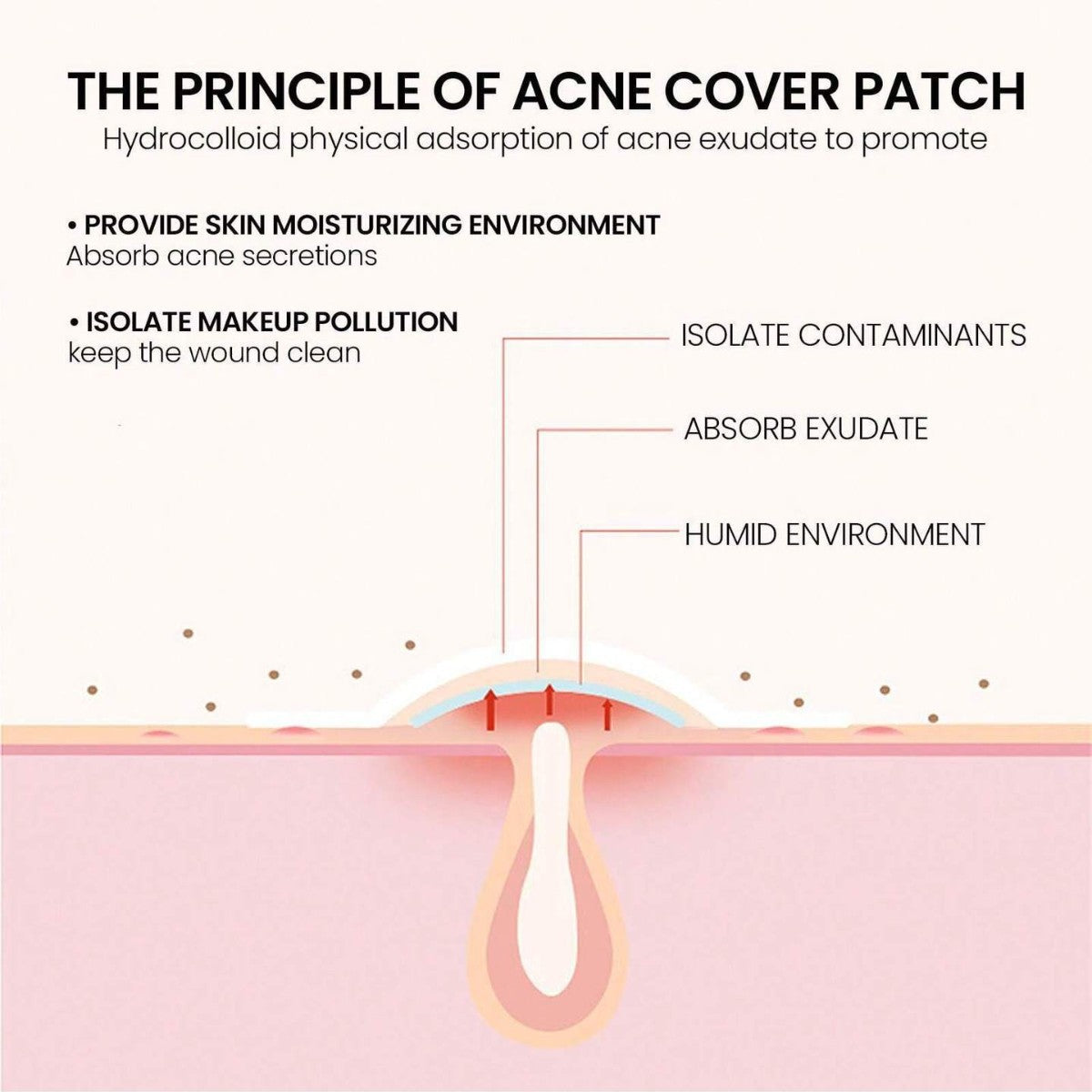 GlowRush Hydrocolloid Acne Pimple Patches – Invisible, Waterproof & Ultra-Thin Spot Treatment Stickers for Fast Healing (200 Count)