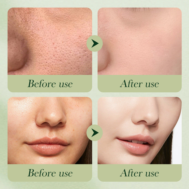 Complete Facial Skincare Set – Hydrating, Anti-Aging & Brightening Daily Skin Care Routine Kit